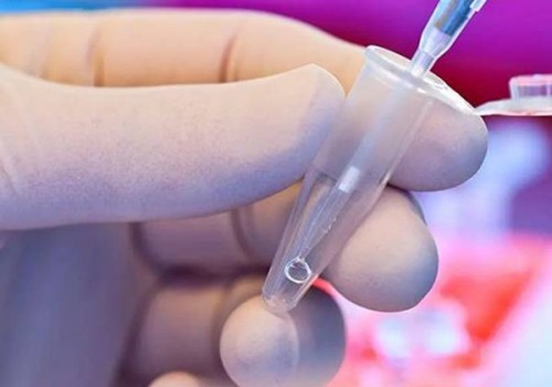 子宫切除对女性身体的危害,谨记术后恢复